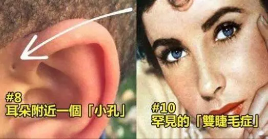 國外網站整理了10大罕見的身體特徵,有些出現的機率甚至比1比100萬還要稀少!