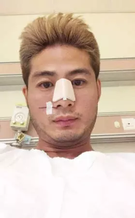 夜店遭三男圍毆濺血 胡問遂鼻樑骨折須整形