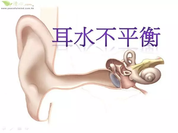 耳水不平衡(暈眩症)--秘方!注意了!