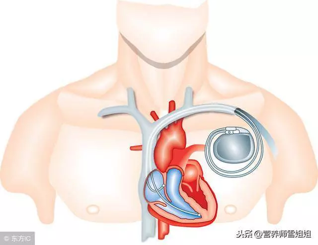 不想心臟「早衰」,堅持「三多三少」,常按四處,強心更健康!