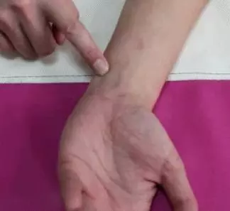 心臟問題的不典型表現,活動心慌、胸悶,呼吸難,2個方法有幫助