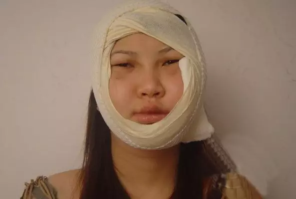 妻子為救丈夫毀了容,丈夫卻選擇再娶,妻子搬家,打開行李箱蒙了