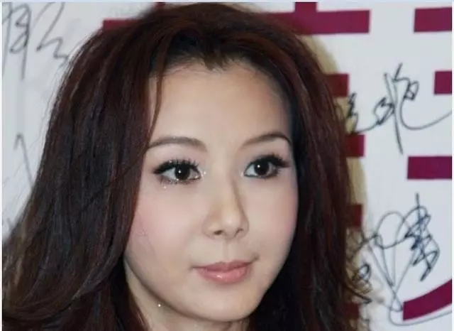 44歲李玟落淚承認科技整容,卻終究逃不過「蔡明臉」!