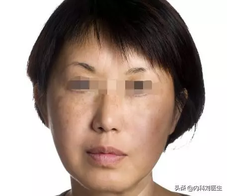 經量少,血塊多,經期不穩定?2物搭配煮著喝,活氣血,驅走寒氣