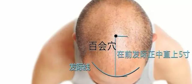 做3道題,測試是否有老年癡呆,結果出來也不怕,4個方法能預防