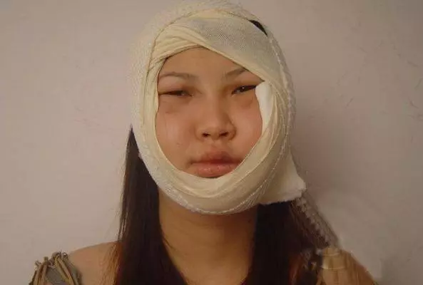 妻子為救丈夫毀了容,丈夫卻選擇再娶,妻子搬家,打開行李箱蒙了