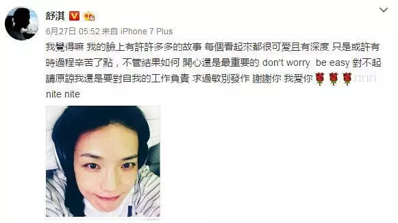 舒淇真的慘!發文暫告演藝圈,4個月沒工作,近照曝光,網友:整張臉太恐怖了!