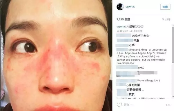 舒淇真的慘!發文暫告演藝圈,4個月沒工作,近照曝光,網友:整張臉太恐怖了。。