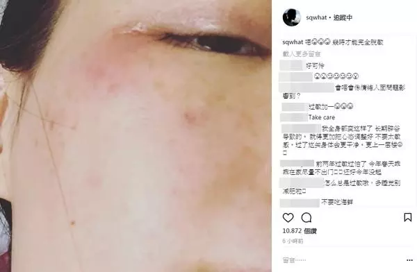 舒淇真的慘!發文暫告演藝圈,4個月沒工作,近照曝光,網友:整張臉太恐怖了。。