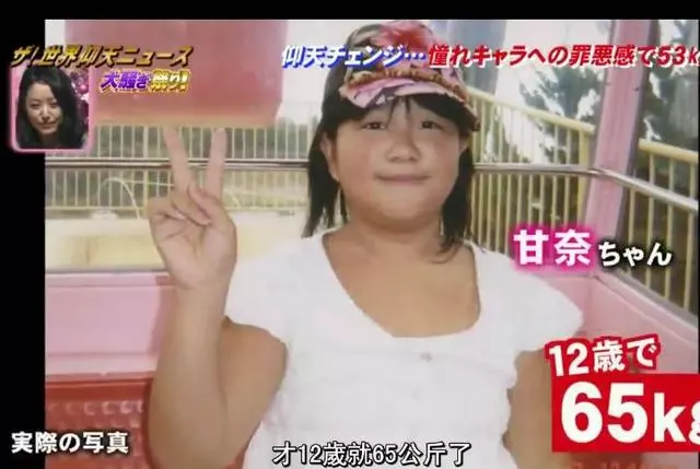 她「從小被家人狂餵食」胖到95公斤...因愛上動漫人物狂鏟肉「變42KG瓜子臉正妹」