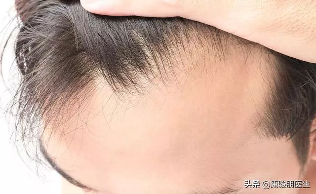 膽經,通經絡、生新發,養氣血,顯年輕,來敲敲