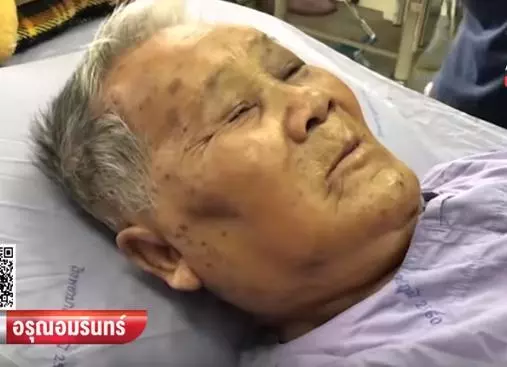 太夭壽!85歲高齡老翁慘遭數百蜜蜂圍攻,「蜂針像一顆顆白白粉刺」布滿臉超驚悚!
