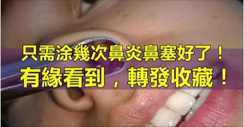 只需塗幾次鼻炎鼻塞好了!有緣看到,轉發收藏!