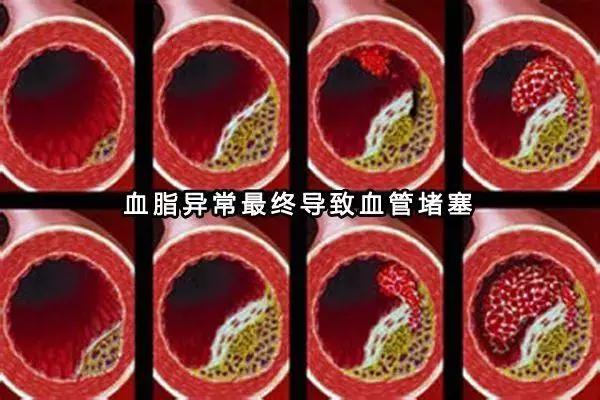 太全了!「三高」人群哪些能吃,哪些不能吃?40歲後人手一份!