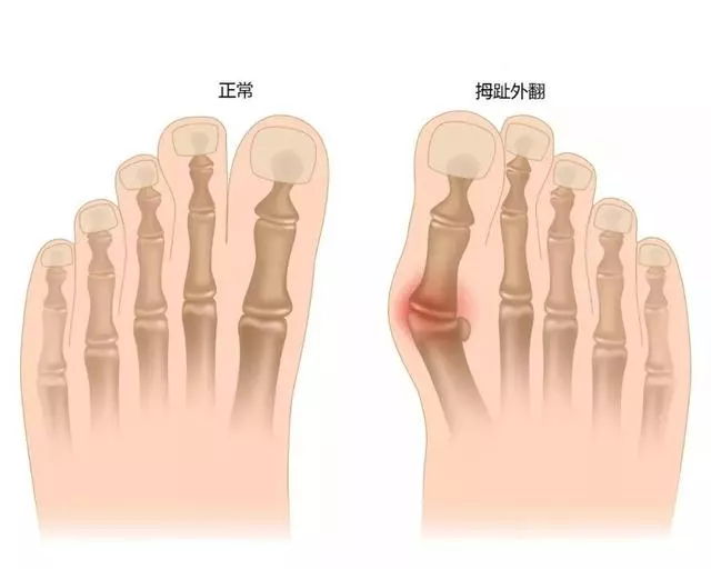 正在毀掉你背部的 4 個錯誤生活習慣