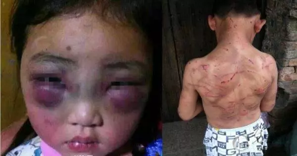 現世報!5歲女孩被繼母虐待,慘死屋內,之後她產嬰孩胎記竟與死去閨女一模一樣! !