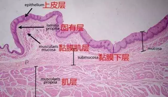 胃病總是反反覆復?消化科醫生手把手教你如何養胃丨腸胃專題