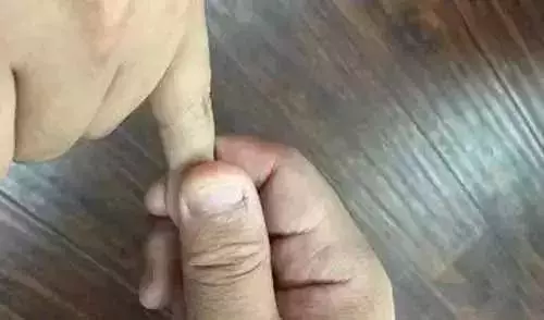 每天按摩小拇指50次,堅持一段時間,腰不疼、腿不酸了,連頭髮也烏黑了,不用去染髮