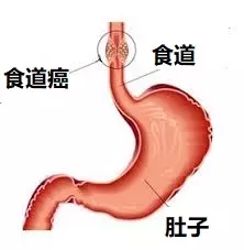 專家警告:快停止這樣喝水!常常這樣喝水癌症機率500%!千萬不要這樣喝!