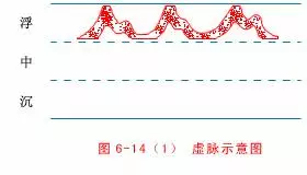中醫把脈手把手教附心法口訣,最全動圖展示一目了然,建議收藏