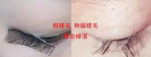 眼睛好看很重要,像紫霞仙子眨一眨眼睛就能讓人為之淪陷~