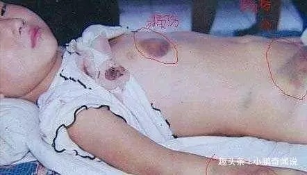 爸媽離婚,孫女睡覺時,奶奶偷偷掀開被子哭喊作惡,不肯原諒兒子