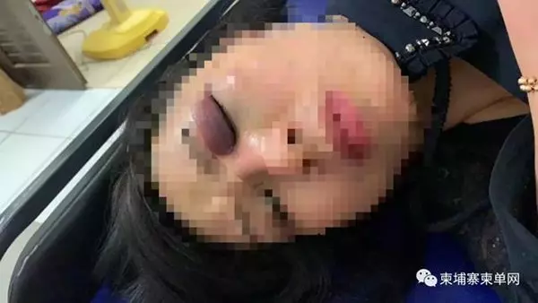 柬埔寨賭場贏錢 8中國遊客遭痛毆