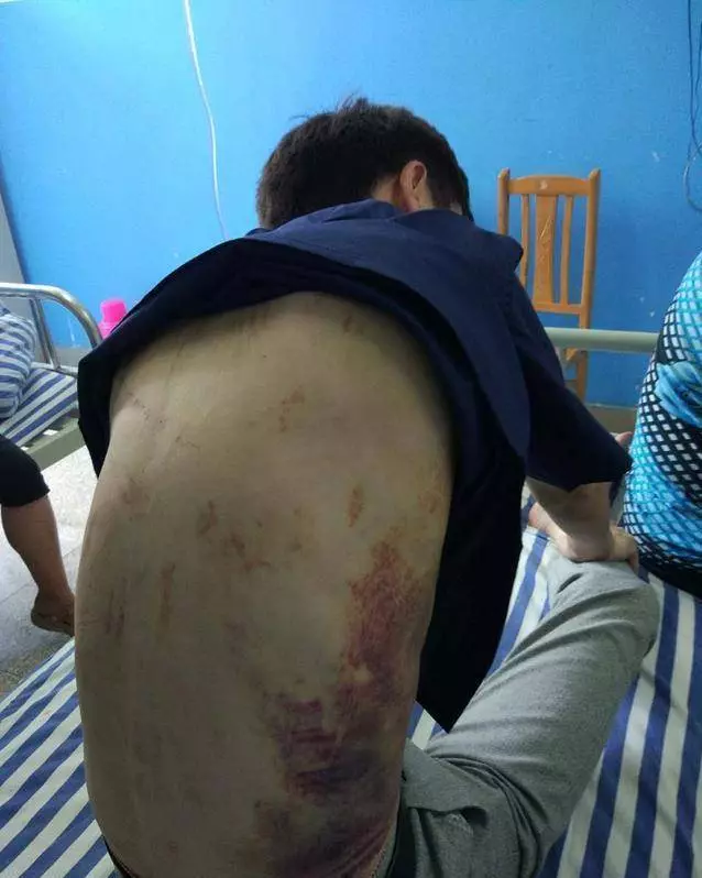 他被網友騙去緬甸,帶進賭場,慘遭囚禁毒打8個日夜「我活著出來了,還有很多人在裡面」
