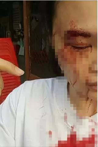好心男子告訴我:「小姐,你車尾有問題」,誰知我停下來查看卻慘遭……後來醫生的做法更叫人寒心!