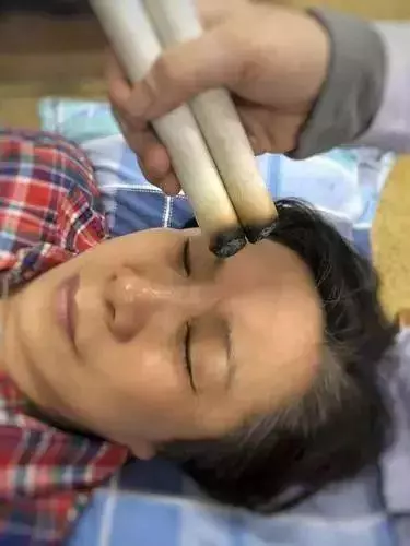 春天宜養陽,醫生教你輕鬆做艾灸,但這幾種人要注意