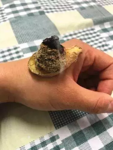春天宜養陽,醫生教你輕鬆做艾灸,但這幾種人要注意
