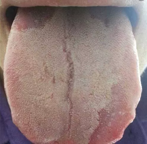 1種小小豆是「排濕王」!每天吃一些,口臭肥胖便秘繞道走