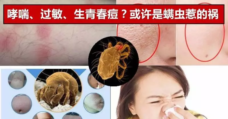蟎蟲到底有多可怕!