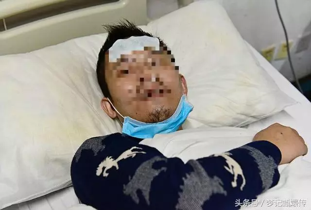 妻子為救丈夫面部毀容,丈夫狠心拋棄她,5年後再見,丈夫扇自己