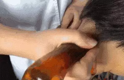刮痧是否出痧,不在於你刮的力度是否夠大,更關鍵的是這一點