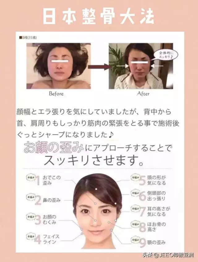 每日即傲一招——解密日本整骨v臉手法