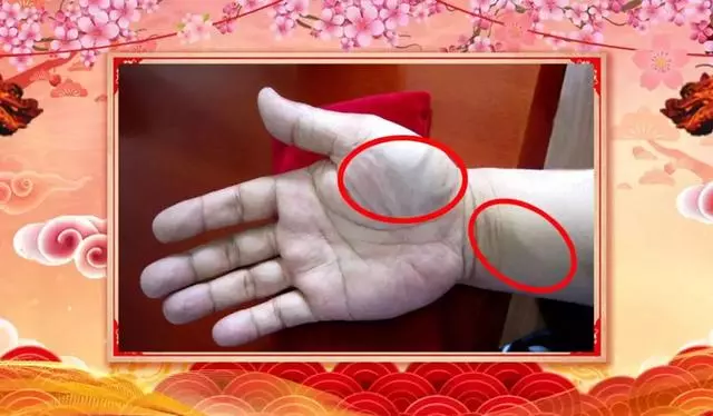 心臟狀況手上看出來!兩個方子通絡降脂、祛火潤燥,清除健康隱患