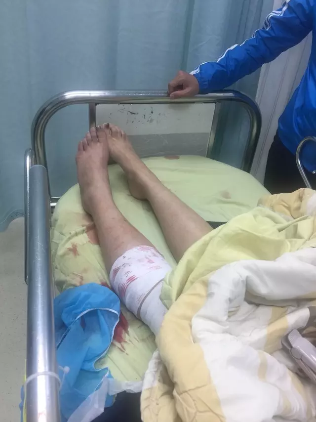 26歲菜鳥女警清槍誤擊 射穿自己小腿
