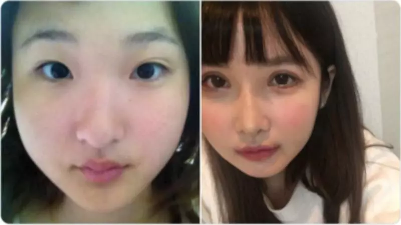「你的樣子會為他人帶來不幸」 老爸一句話讓日本少女花400萬整形