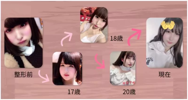 「你的樣子會為他人帶來不幸」 老爸一句話讓日本少女花400萬整形