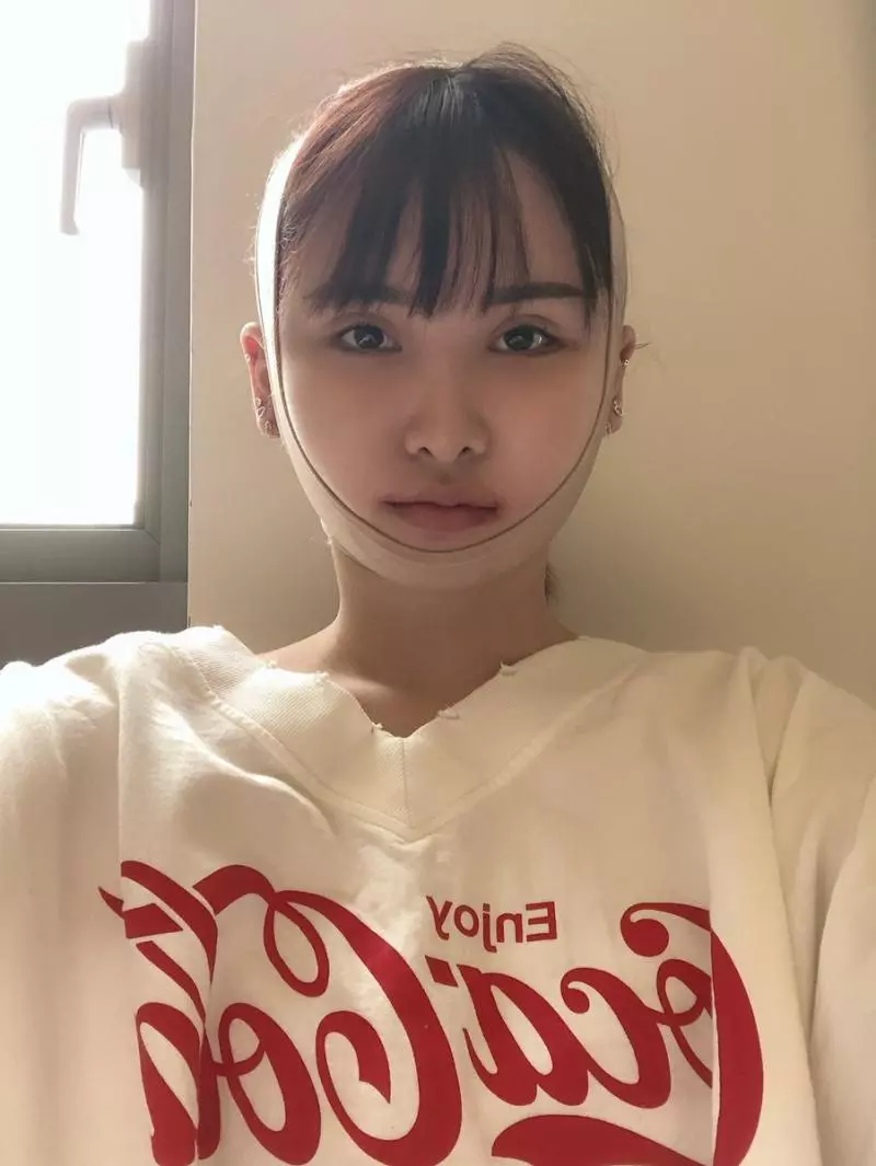 「你的樣子會為他人帶來不幸」 老爸一句話讓日本少女花400萬整形