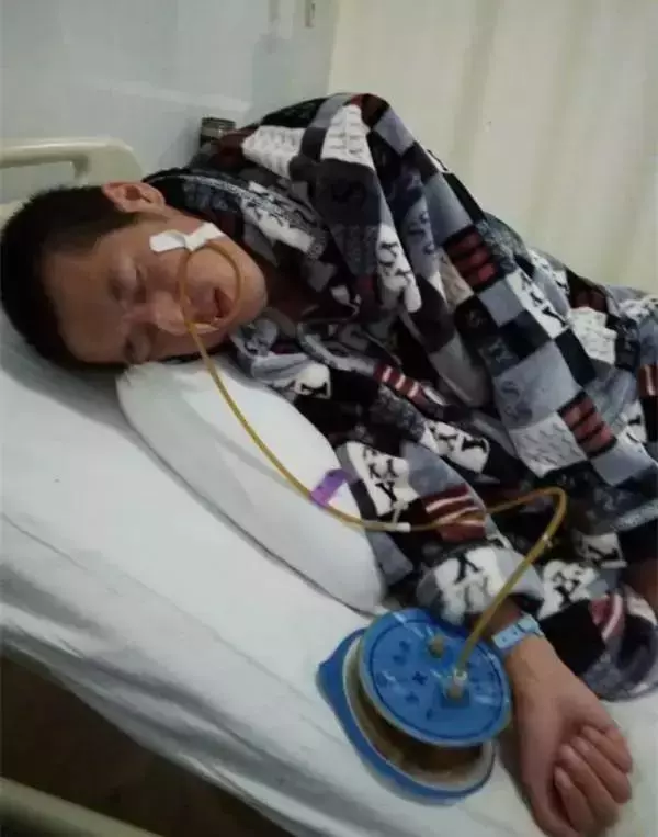 20歲小伙便血入院,查出直腸癌,醫生:這種「息肉」小心癌變