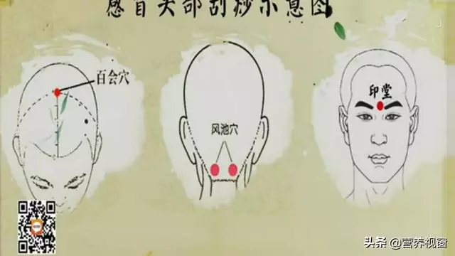 【手到病除刮痧治感冒】