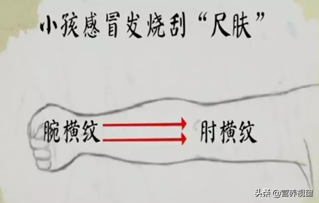 【手到病除刮痧治感冒】