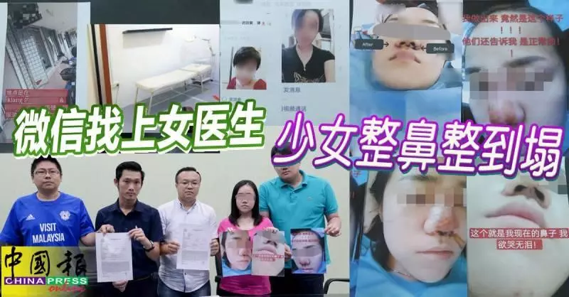 微信找上女醫生 吉隆坡少女整鼻整到塌