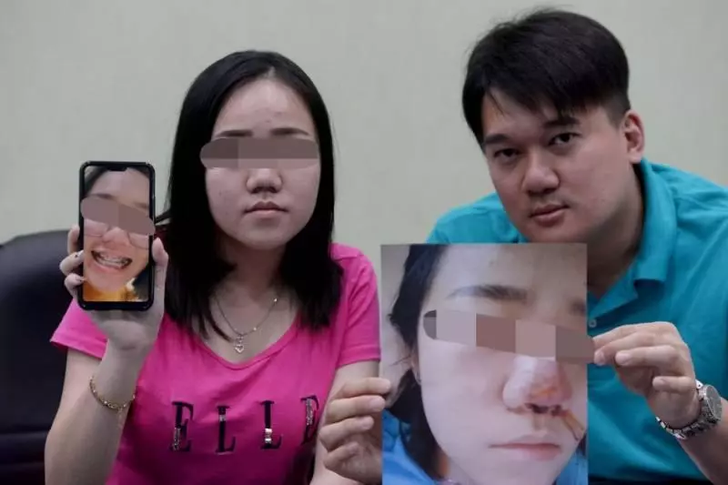 微信找上女醫生 吉隆坡少女整鼻整到塌