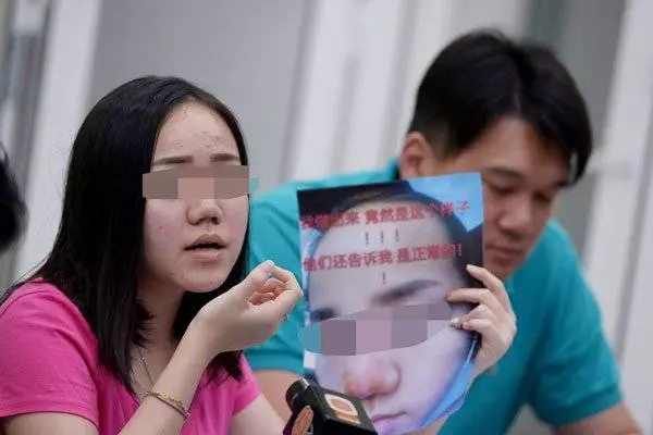 微信找上女醫生 吉隆坡少女整鼻整到塌