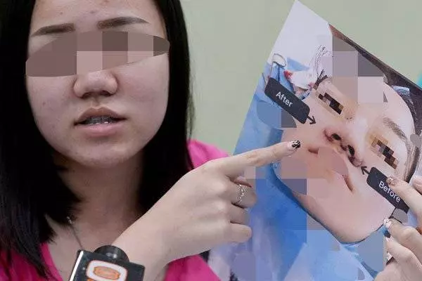 微信找上女醫生 吉隆坡少女整鼻整到塌