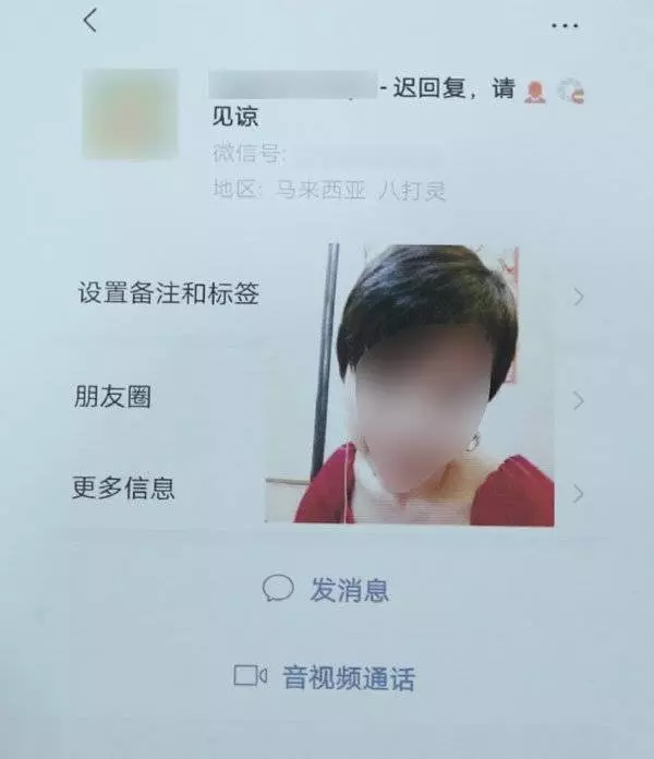 微信找上女醫生 吉隆坡少女整鼻整到塌