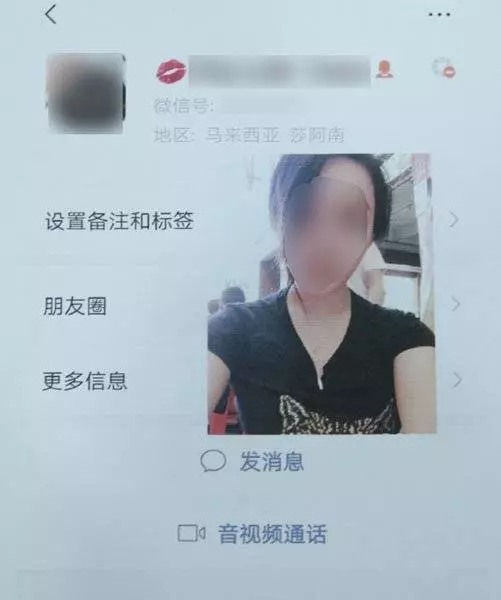 微信找上女醫生 吉隆坡少女整鼻整到塌